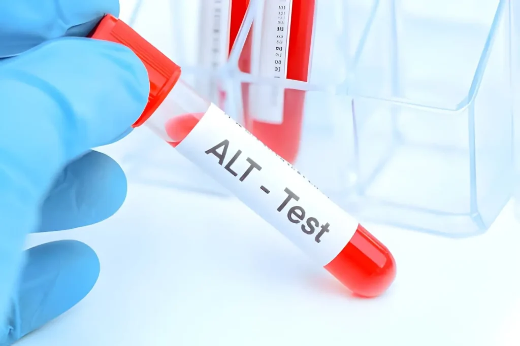 Understanding ALS Genetic Testing